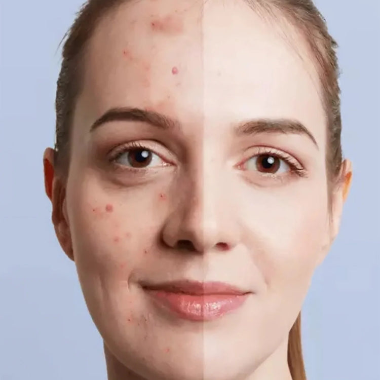 Soins Visage